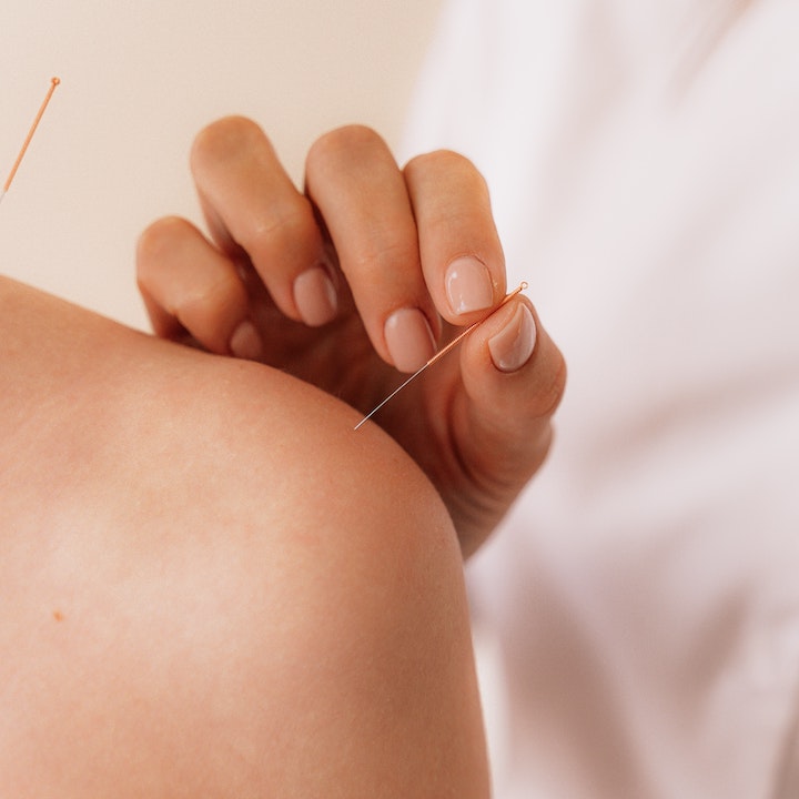 alternative therapy hong kong health wellness acupuncture