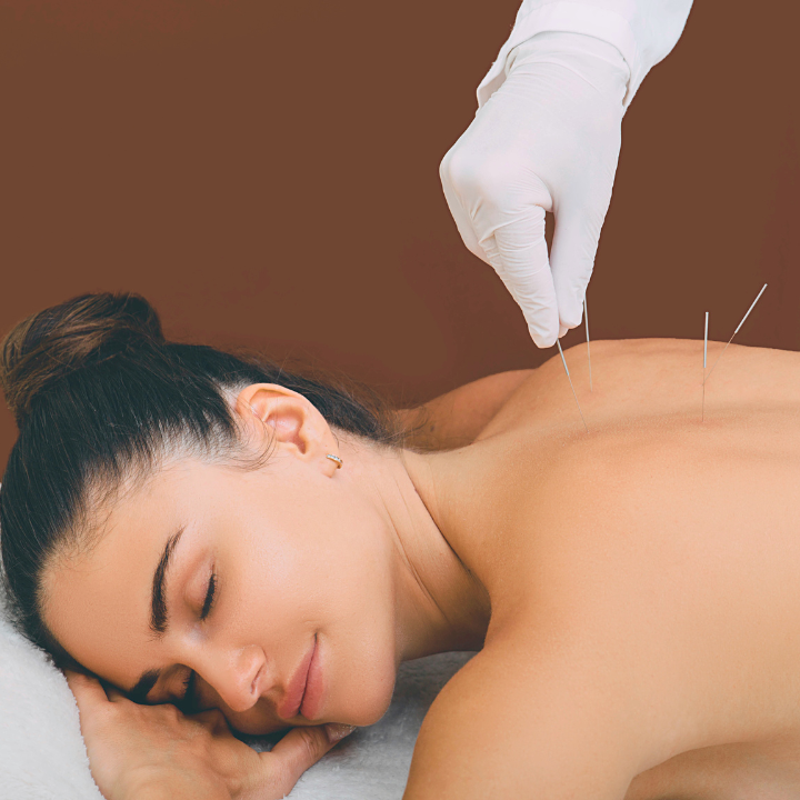 holistic healing acupuncture