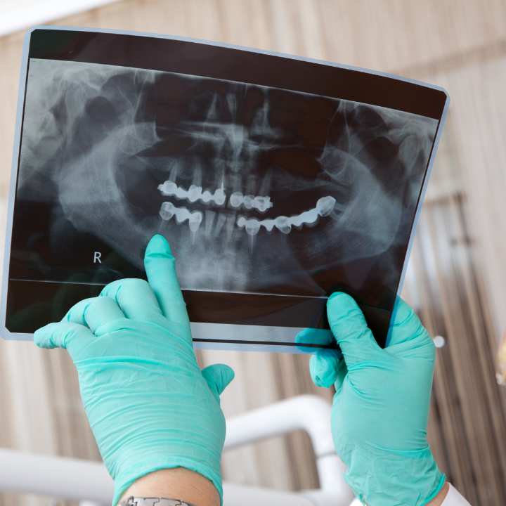 Teeth Whitening Dental Clinics Hong Kong