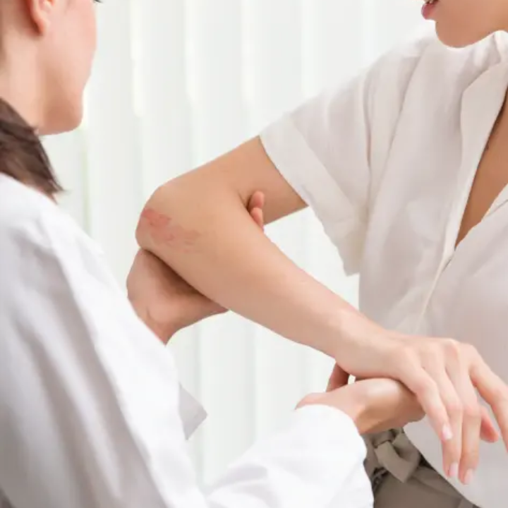 Consult a doctor or pharmacist for severe heat rash in hong kong