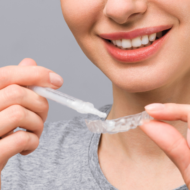 Teeth Whitening Dental Clinics Hong Kong