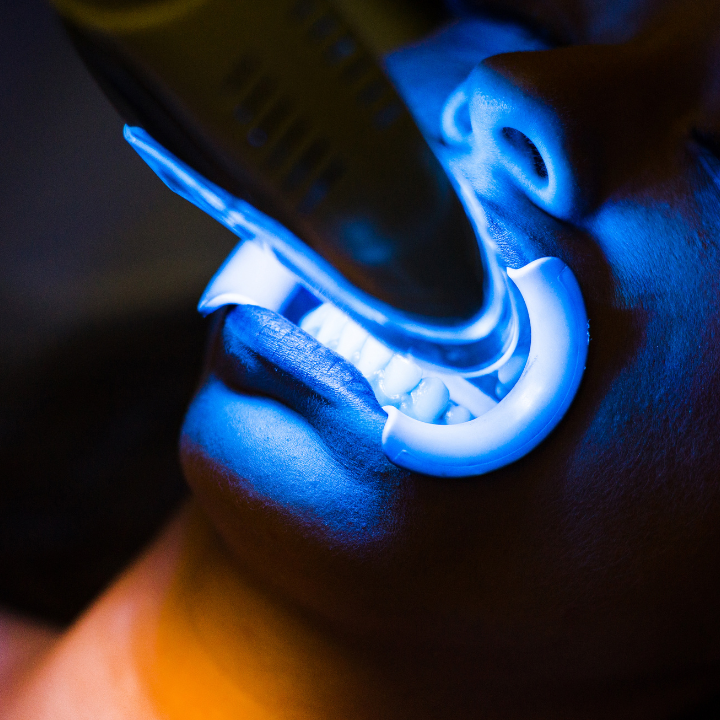 Teeth Whitening Dental Clinics Hong Kong