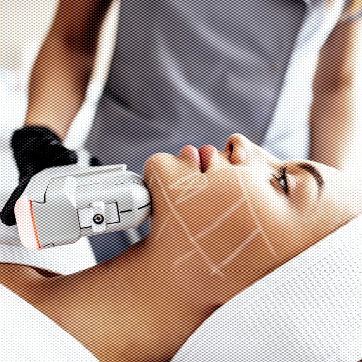 HIFU treatment that gave me burns Team Sassy’s Beauty Treatment Horror Stories